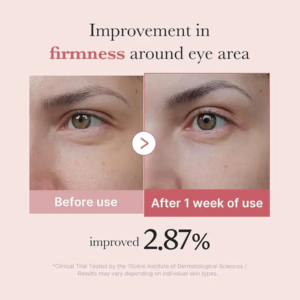 Medicube PDRN Pink Peptide Eye Cream – eye cream for dark circles and fine lines key benefits Medicube PDRN Pink Peptide Eye Cream - eye cream for dark circles and fine lines key benefits