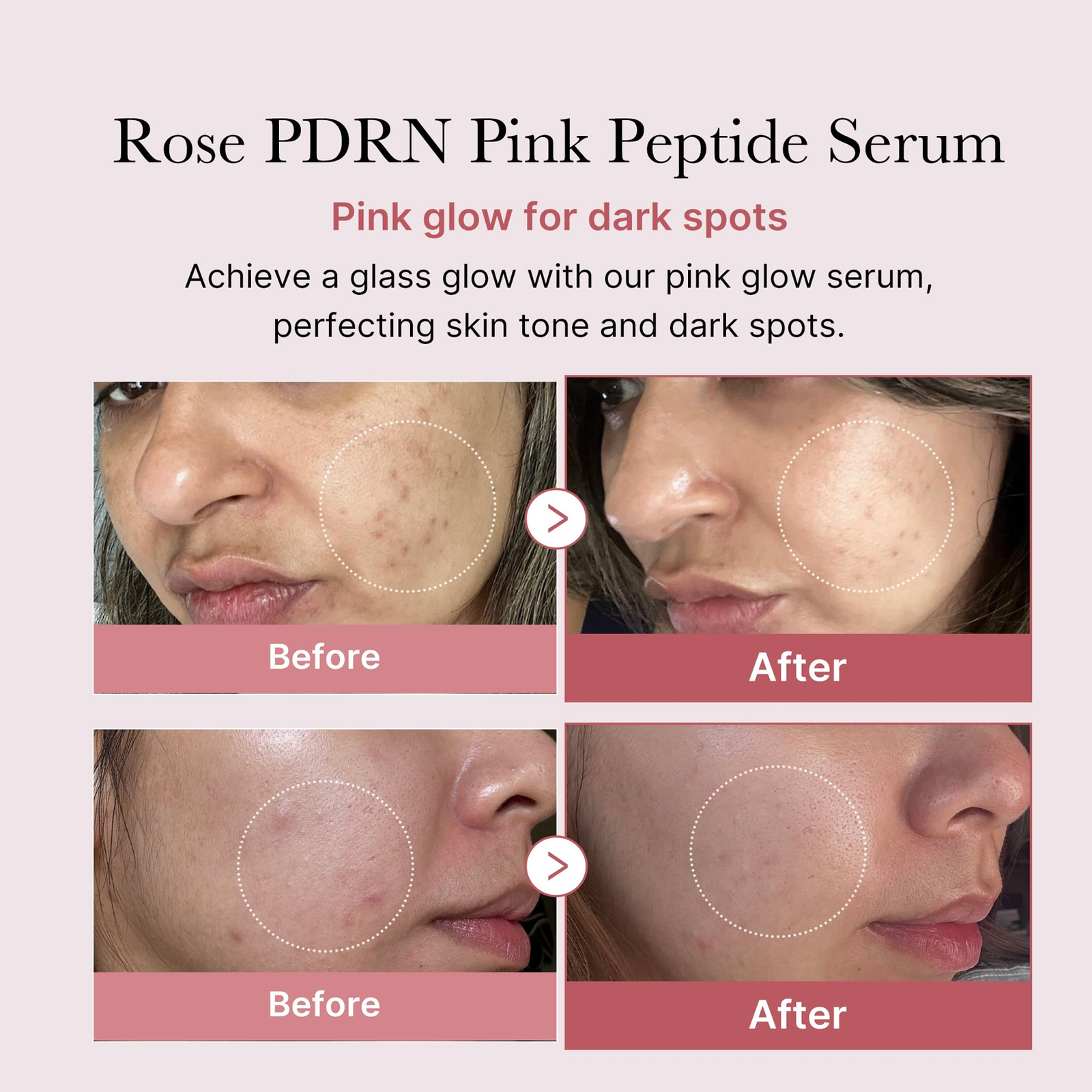 Medicube PDRN Pink Peptide Serum - 30ml