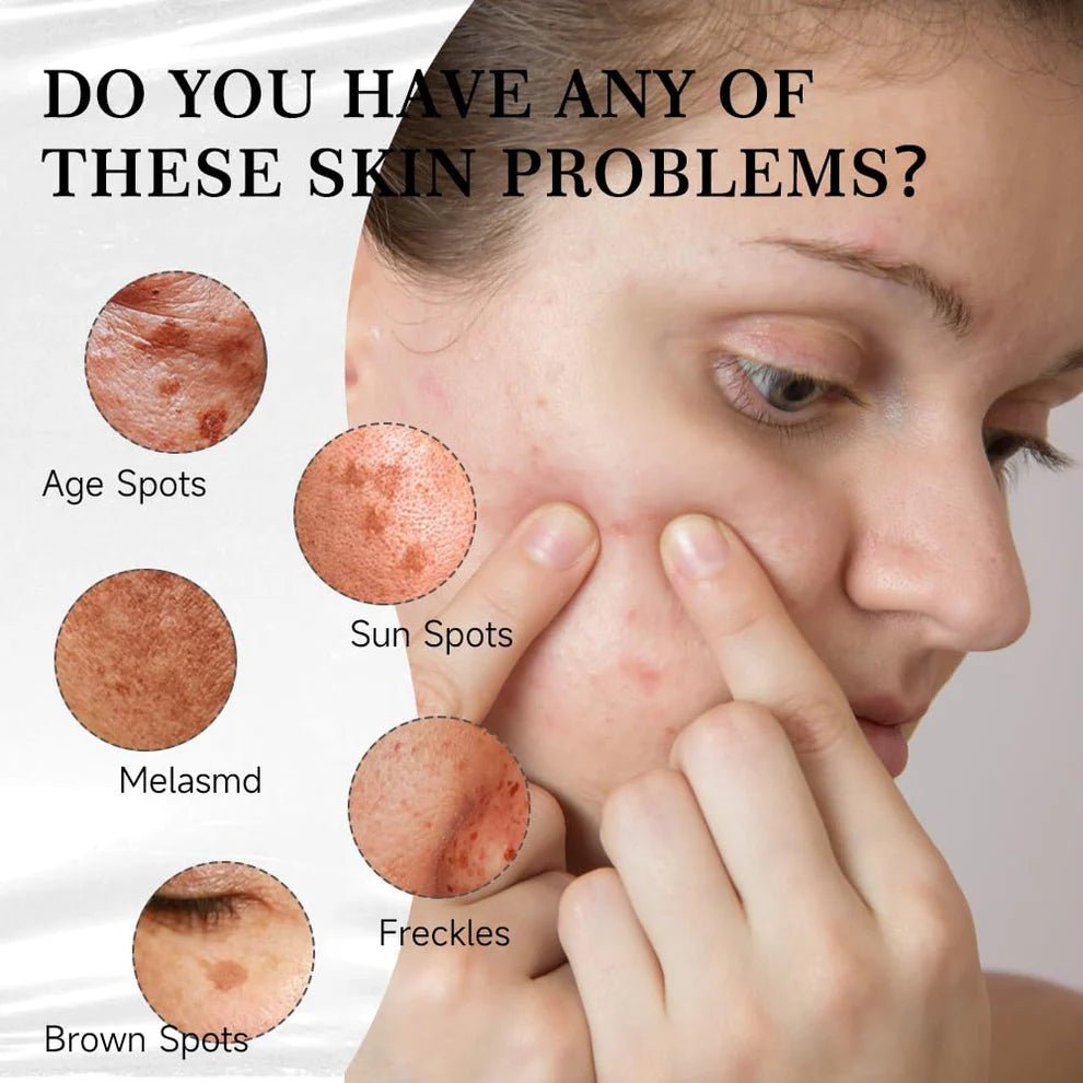 Aobenz Dark Spot Correcting Serum — photo 2