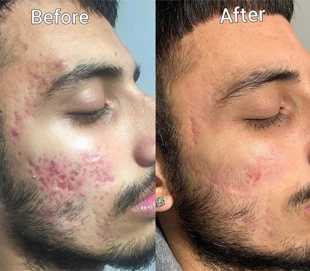 Aobenz Dark Spot Correcting Serum — photo 5