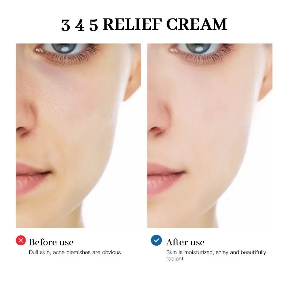 Dr Althea 345 Relief Cream before and after use results