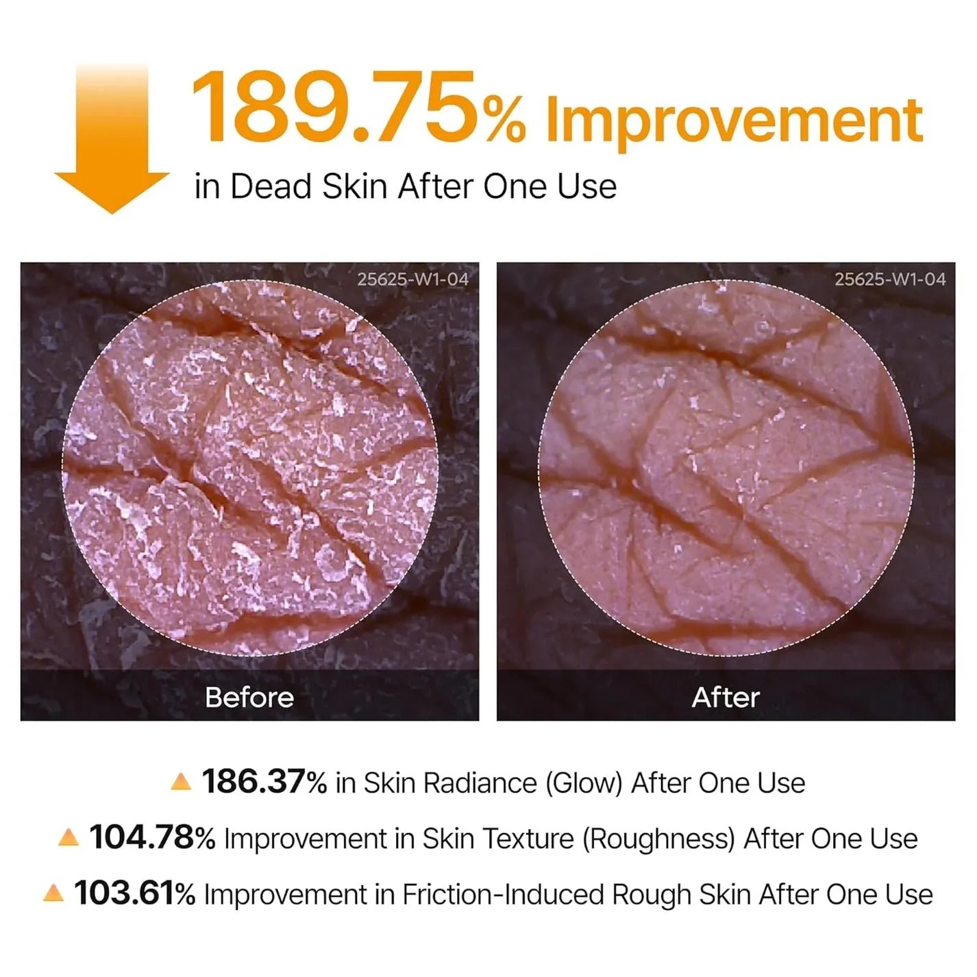 Dr Melaxin Peel Shot dead skin exfoliation results