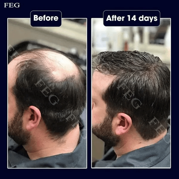 FEG Plus Eyelash and Eyebrow Serum — photo 3