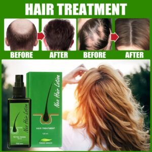 Neo Hair and Scalp Lotion 120ml Kuwait